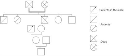 Perioperative Management of Patient with Esophageal Carcinoma and Crigler-Najjar Syndrome Type 2: A Case Report